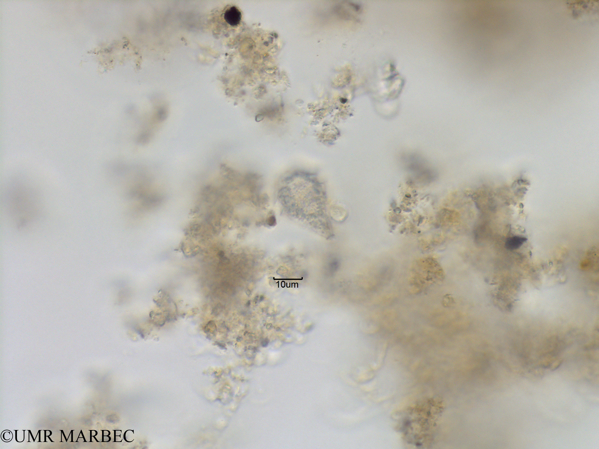 phyto/Bizerte/bizerte_lagoon/RISCO November 2015/Scrippsiella spinifera (Protoperidinium sp15-Lagune_T5_CW3-Proto allongé-0).tif(copy).jpg